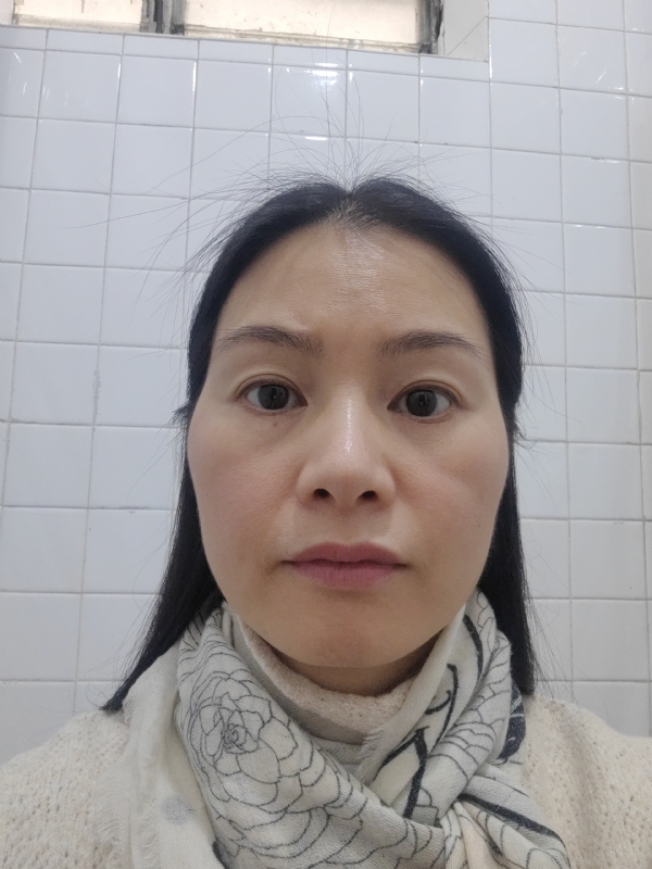 罌粟花的第一张照片--九龙残疾人相亲网